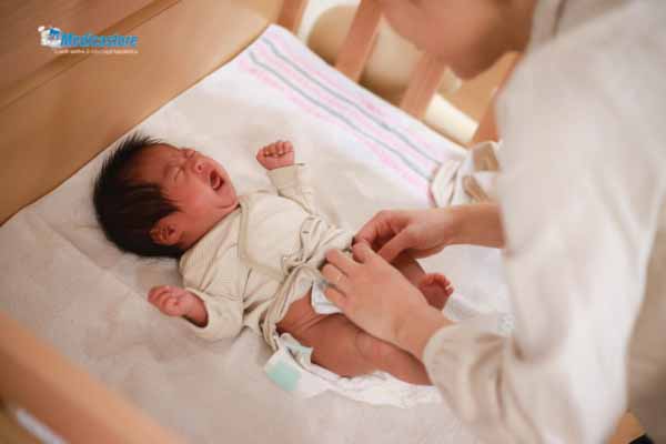 Cara Mengatasi Ruam Popok pada Bayi