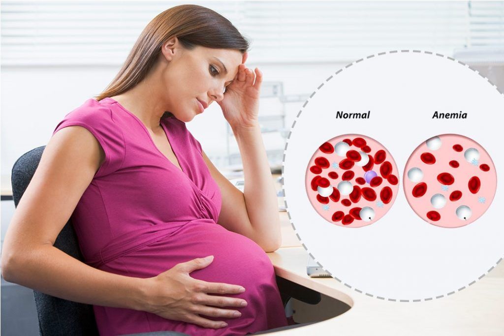 Anemia pada Kehamilan