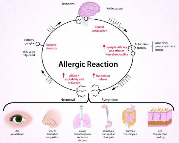 Reaksi Alergi