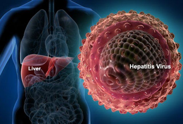 Hepatitis Virus Akut