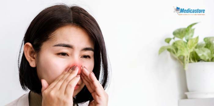 7 Produk untuk Mengatasi Hidung Tersumbat Tanpa Obat