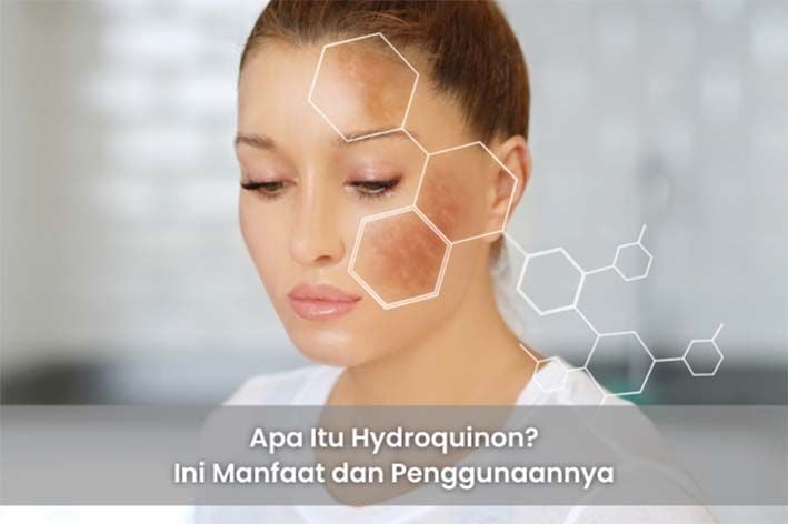 Apa Itu Hydroquinon? Ini Manfaat dan Penggunaannya