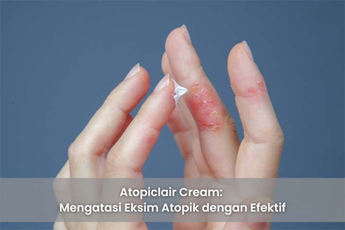 Atopiclair Cream: Mengatasi Eksim Atopik dengan Efektif