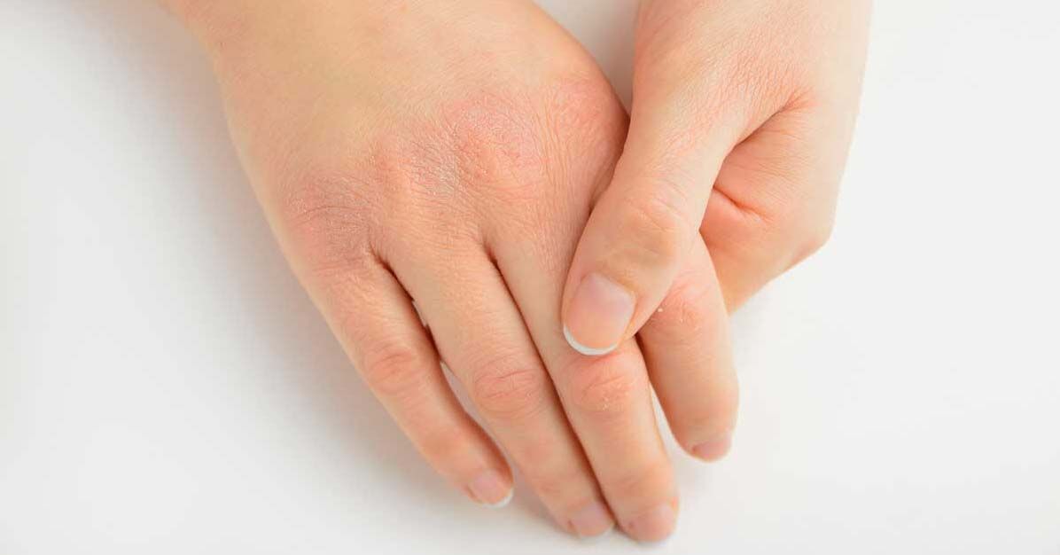 Ini Dia Becom Zet, Multivitamin Terbaik Untuk Defisiensi Vitamin Di Tubuh