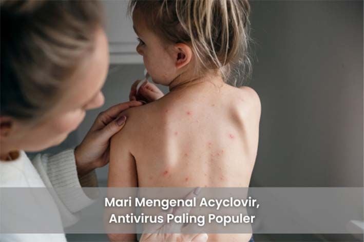 Mari Mengenal Acyclovir, Antivirus Paling Populer