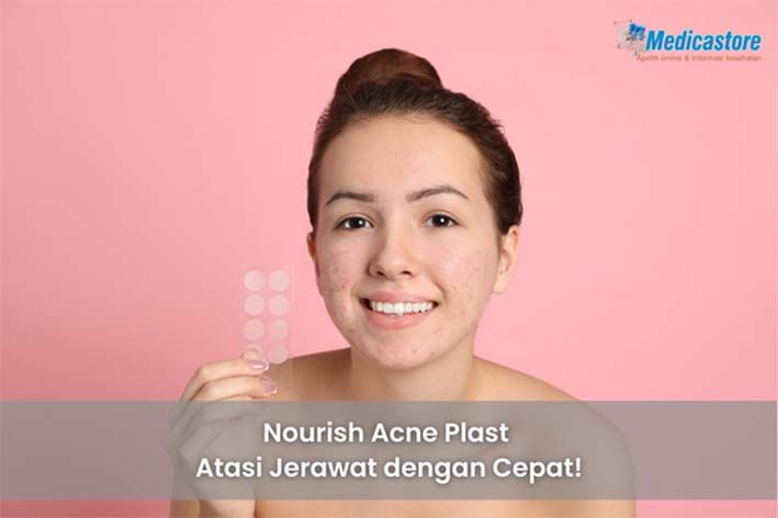 Nourish Acne Plast, Atasi Jerawat dengan Cepat!