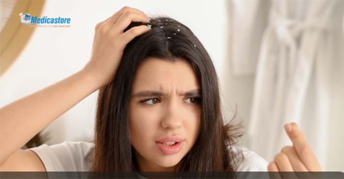Penyebab Rambut Berketombe yang Sering Terabaikan dan Cara Mengatasinya