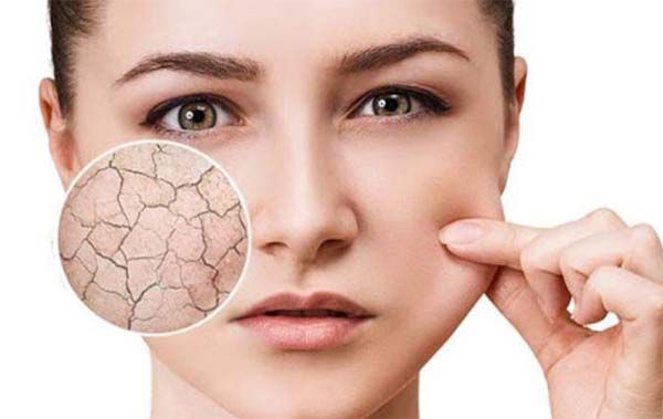 Rekomendasi Beragam Produk Sebamed Anti Dry Series Terbaik