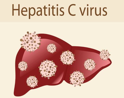 mengenal hepatiti c dan cara mencegah infeksi hepatitis 