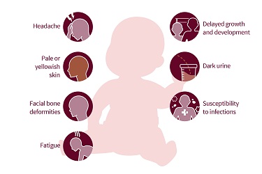 gejala thalassemia