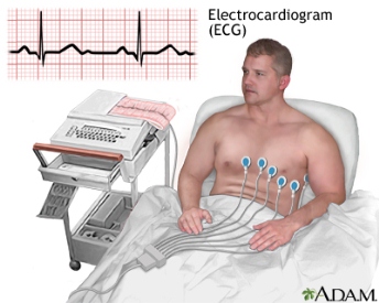 pemeriksaan Elektrokardiografi EKG jantung
