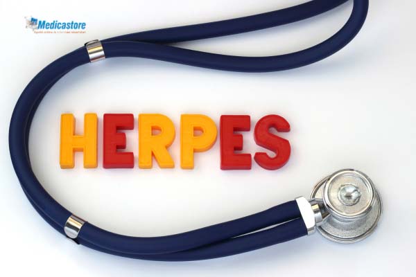 Mengenal penyakit Herpes