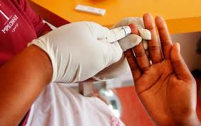 Hiv