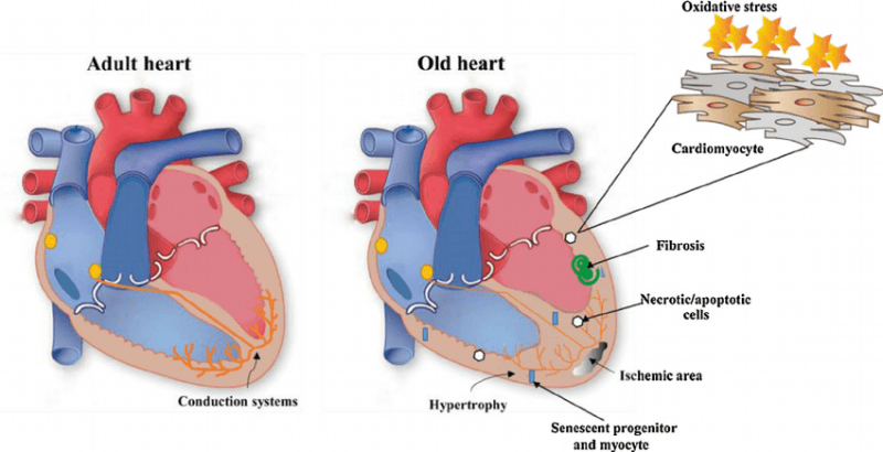 Efek Penuaan pada Jantung dan Pembuluh Darah