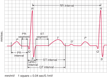Elektrokardiografi (EKG)