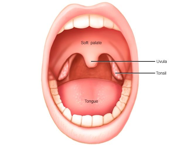 Kanker Tonsil (Amandel)