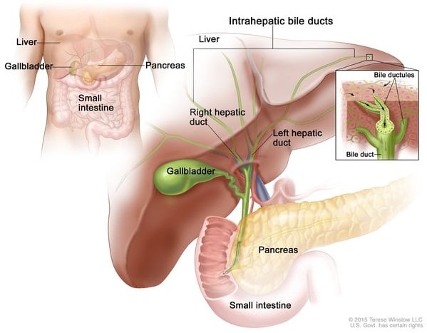 Kolestasis