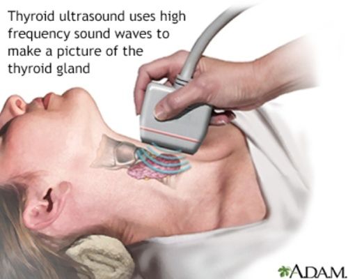 Pemeriksaan Ultrasonografi Kelenjar Tiroid