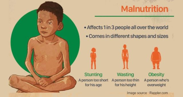 Malnutrisi - Kurang Gizi, Kelebihan Gizi