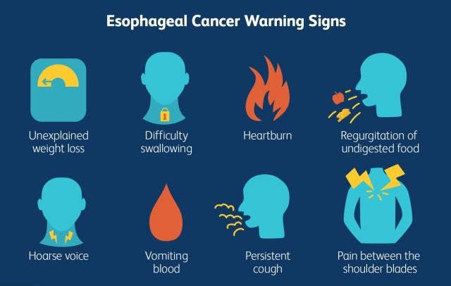 gejala kanker esofagus