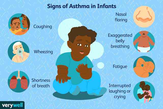 Gejala asma pada bayi