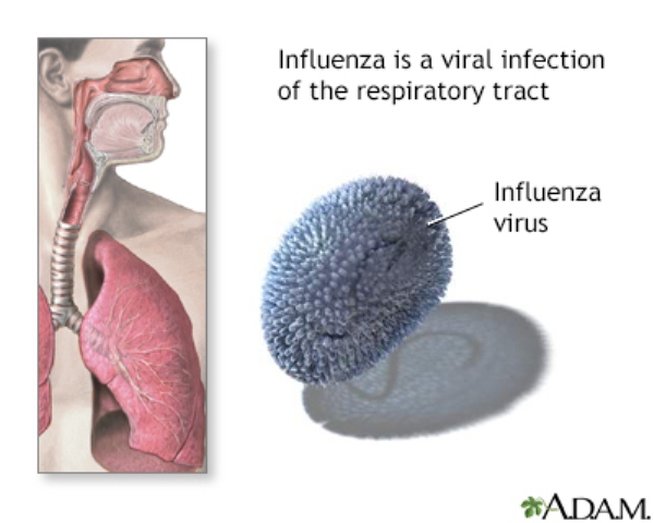penyebab influenza